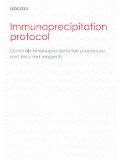 Immunoprecipitation protocol - Abcam