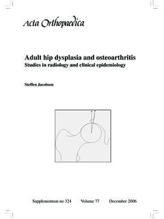 Adult hip dysplasia and osteoarthritis - of-aarhus.dk