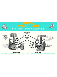 Ottawa Ankle Rules - Ottawa Hospital Research Institute