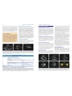 Measuring the Size of the Aortic Aneurysm Sinus of ...