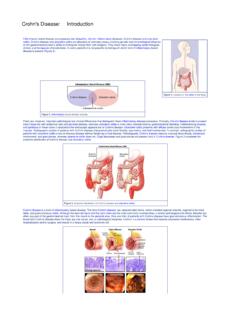 Crohn's Disease: Introduction - Hopkins Medicine