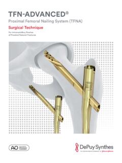Proximal Femoral Nailing System (TFNA) Surgical Technique