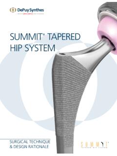SUMMIT TAPERED HIP SYSTEM