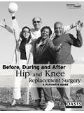 Hip and Knee Replacement Surgery