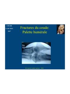 COUDE Fractures du coude - ClubOrtho.fr