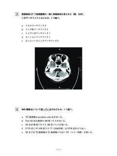 1 頭部単純CTで後頭蓋窩の一部に低吸収域が見られ …
