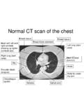 Normalabnormal CT scan of the chest - Life