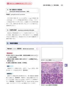 皮膚の悪性腫瘍／D．神経系腫瘍 - derm-hokudai.jp