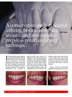 A conservative smile makeover utilizing both a minimally ...
