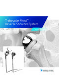 Trabecular Metal Reverse Shoulder System - …