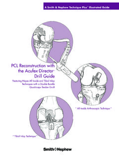 PCL Reconstruction with the Acufex Director Drill Guide